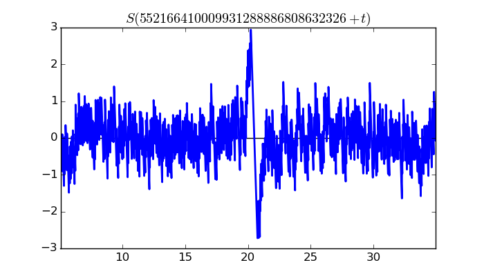 zeta function picture