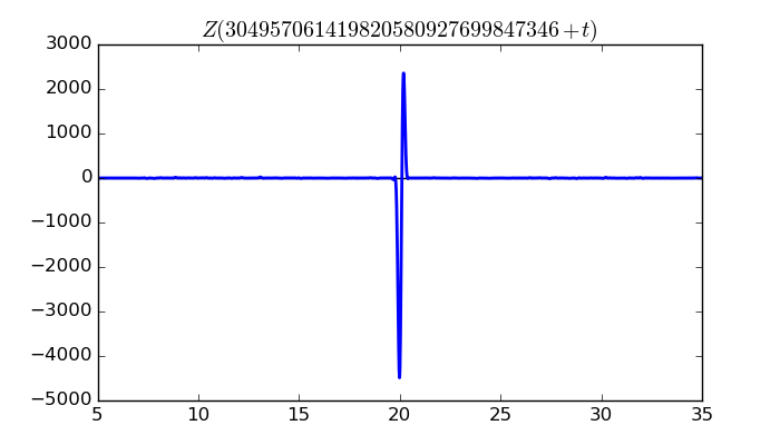 zeta function picture