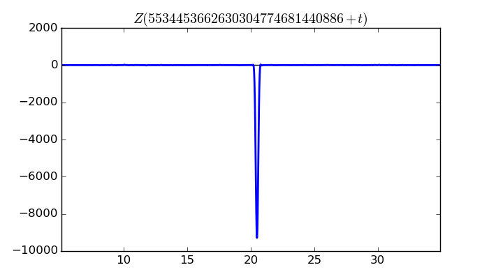 zeta function picture